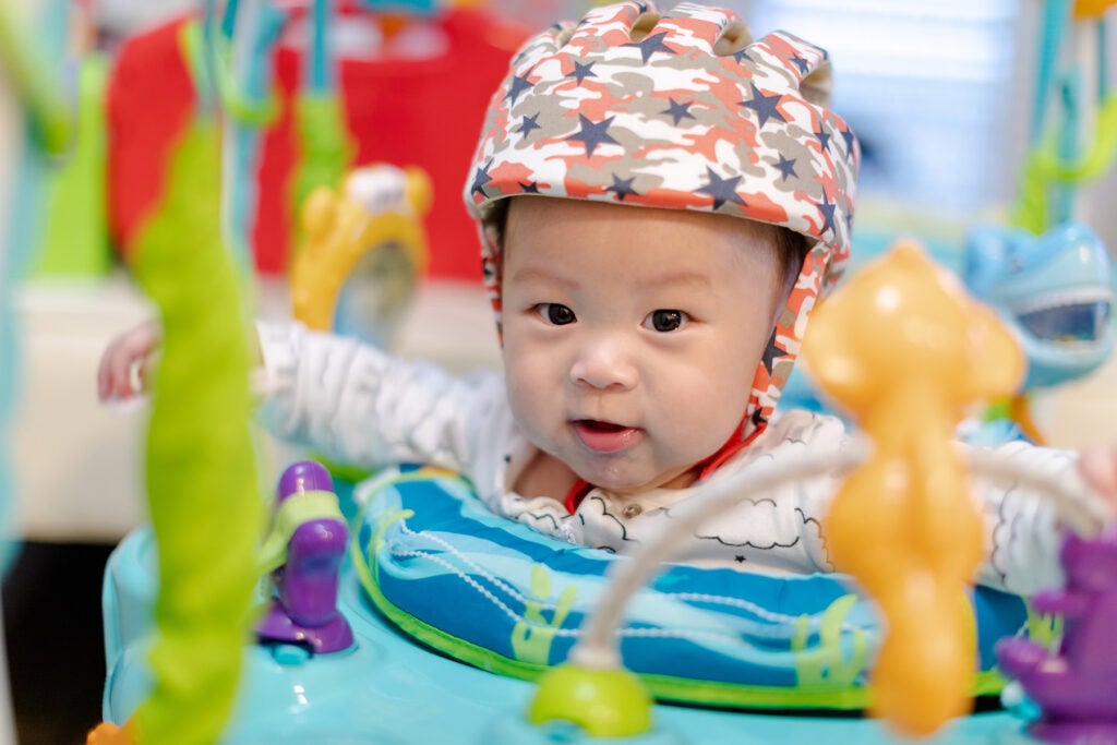 Four month old baby with a helmet